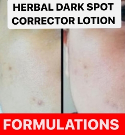 HERBAL DARK SPOT CORRECTOR LOTION FORMULATIONS AND PRODUCTION PROCESS