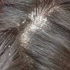 Preparation of hair herbal oils for repairing hair scalp with herbal essential oils | Formulations