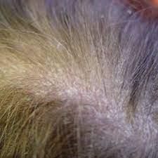 Ingredients of hair herbal oil for repairing hair scalp with herbal essential oils | Production Process